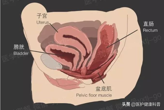 产后防止子宫脱垂动作,产后修复远离漏尿