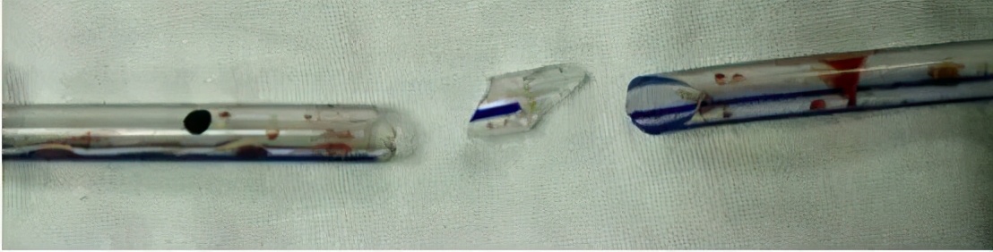 关于放置与拔除引流管那点事，你掌握了吗？