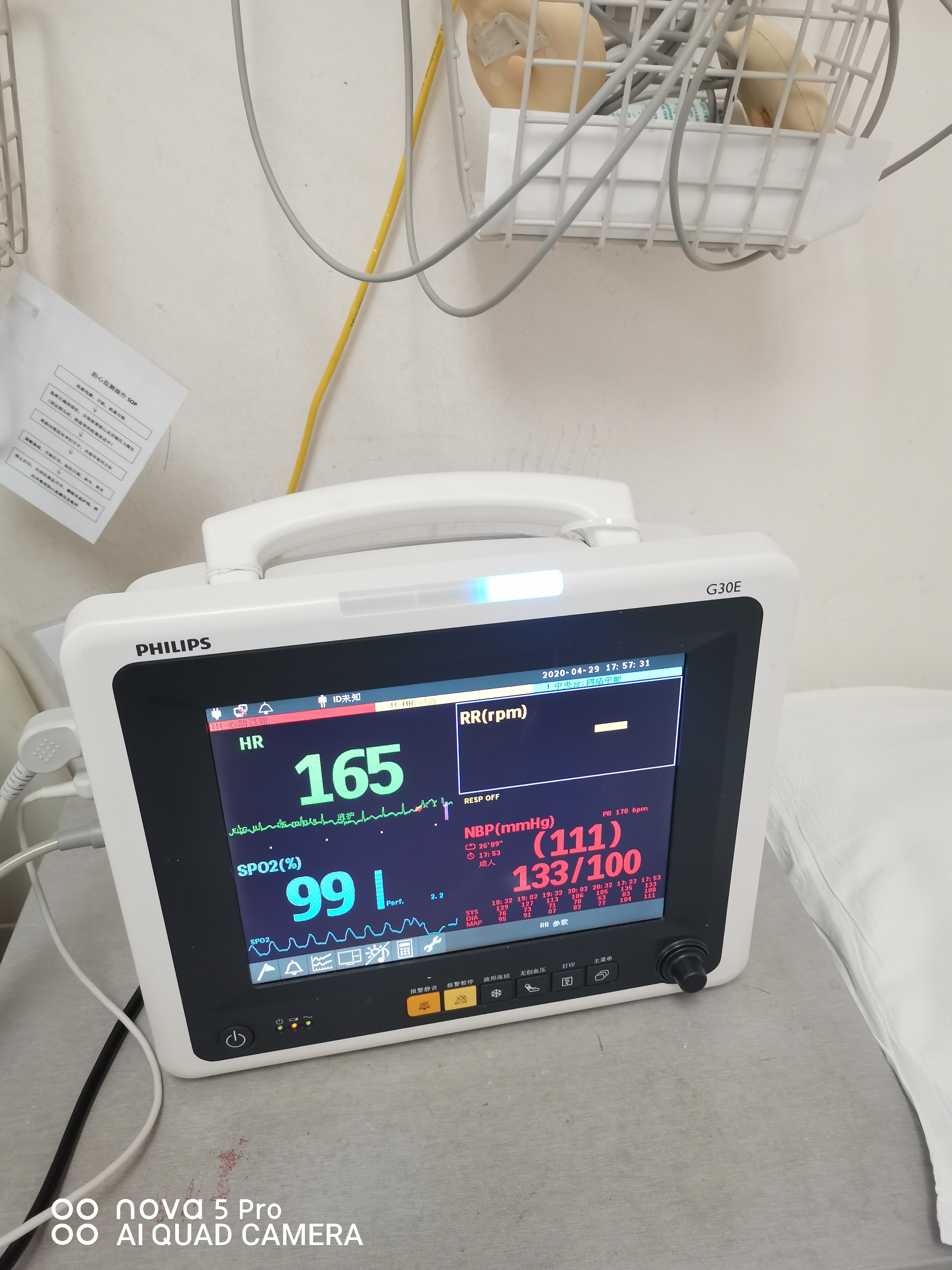 孕妇25周心动过速怎么办,孕28周孕妈心动过速