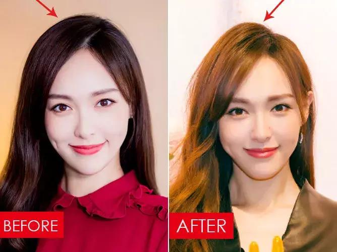 拯救发际线告别大额头,拯救发际线不走冤枉路