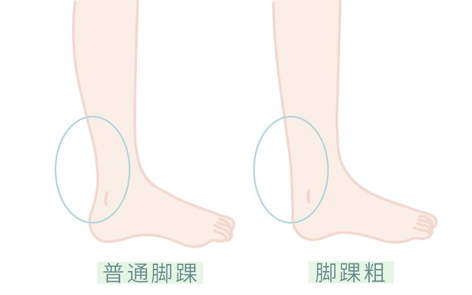 不夹脚不挤脚适合任何脚型,脚型不好穿啥鞋都磨脚和挤脚