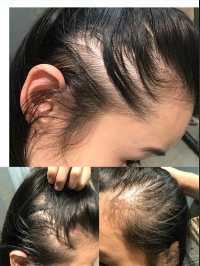 这些护肤误区千万别踩,6大护肤雷区你中枪了吗