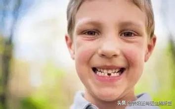 12岁前必须解决的错颌畸形,孩子十二岁牙畸形怎么办
