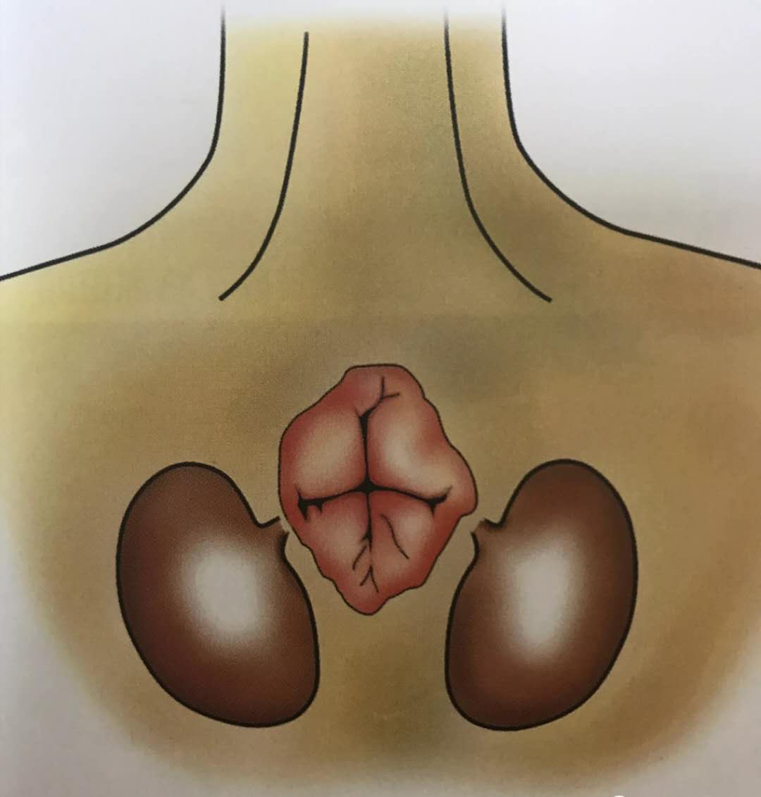 猫咪需要挤肛门腺的症状,猫咪需要挤屎