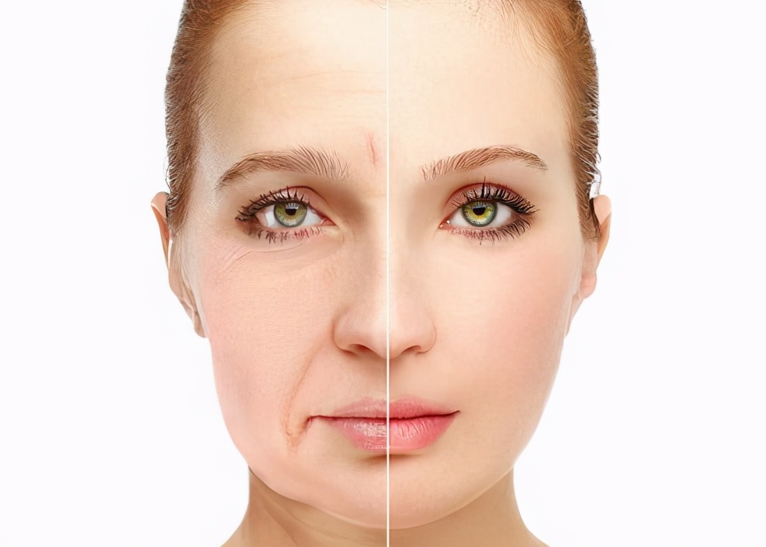 打完菲洛嘉小棕瓶能化妆吗,菲洛嘉适合跟小棕瓶一起打吗