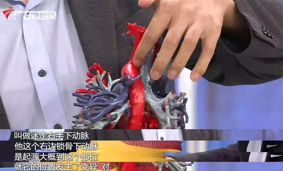 主动脉夹层手术后会猝死吗,主动脉夹层破裂猝死有救吗