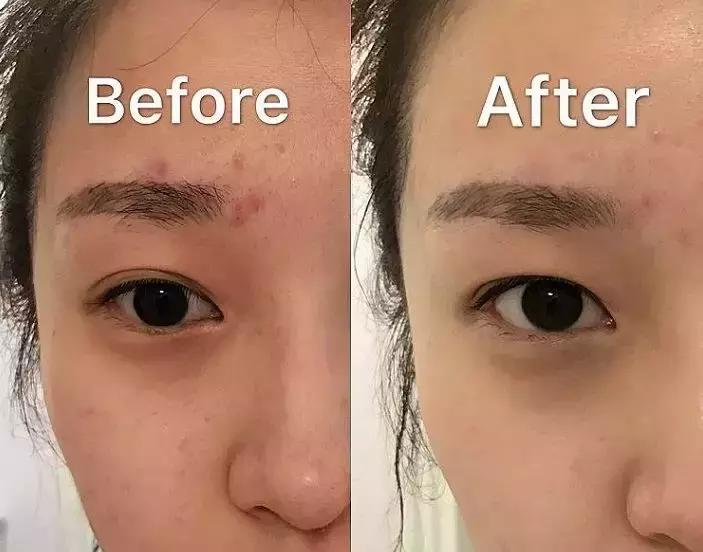 烟酰胺玻尿酸水光焕颜片美白效果,烟酰胺玻尿酸精华液美白淡斑霜