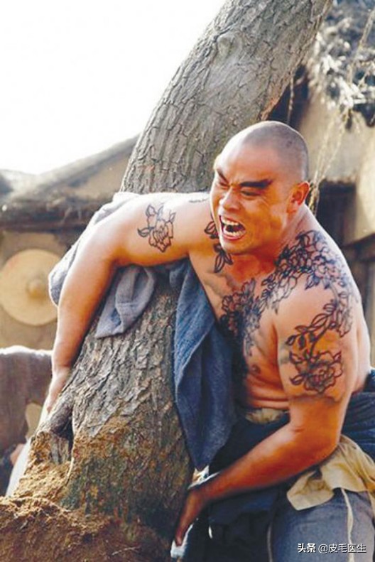 忍不住想给梁山好汉，送一台激光治疗仪