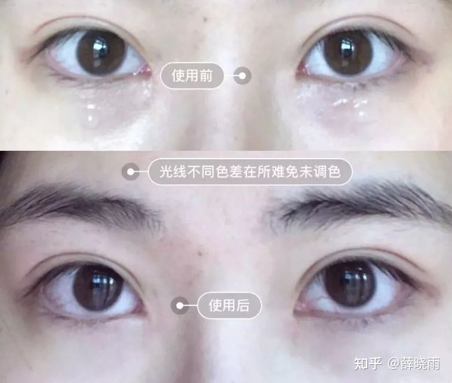 抗老眼霜推荐,a醇眼霜推荐