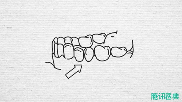 口腔医生：牙缝里的牙垢又臭又硬，教你几个小妙招，牙龈不再出血