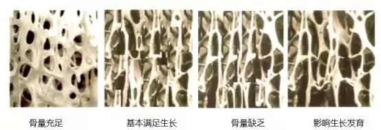 娃儿喊脚酸是什么情况,小孩子说脚痛和肚子痛是什么病