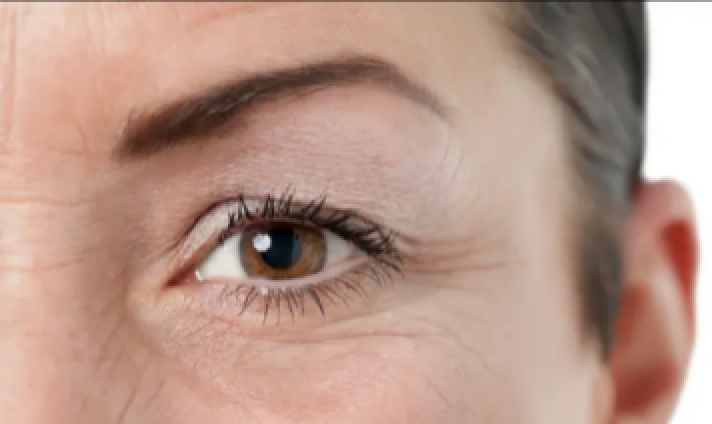 双眼皮下垂怎么矫正视频,双眼皮下垂怎么做修复