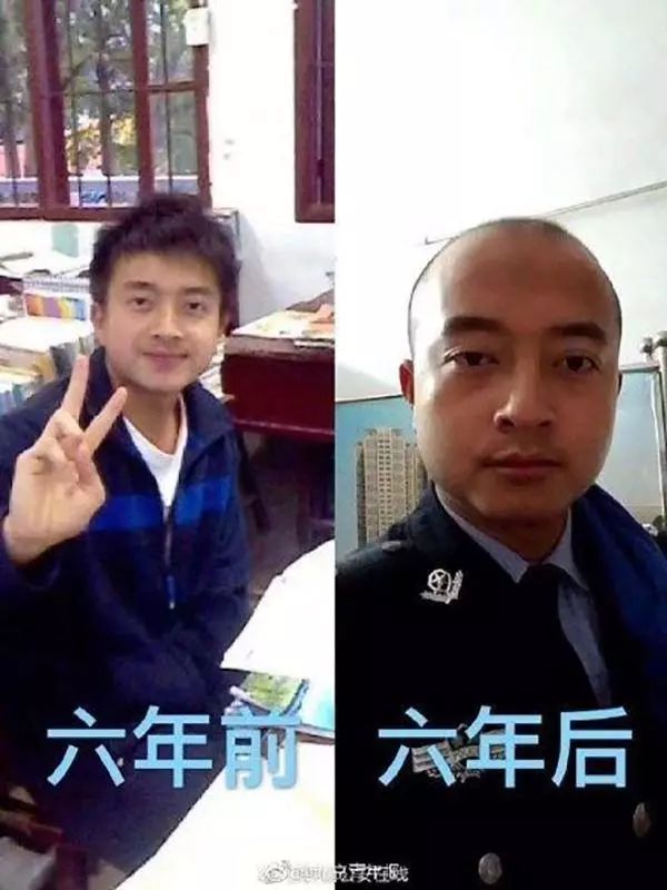 如何才能解决油脂性脱发,脱发地中海应该怎么治疗