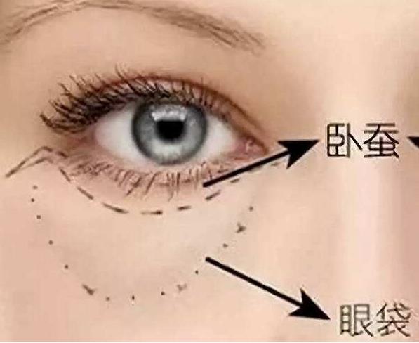 眼袋和卧蚕的区别教你区分小妙招,卧蚕和眼袋傻傻分不清的说说