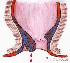 酒喝多吐了不醉,酒喝多了吐好还是不吐好