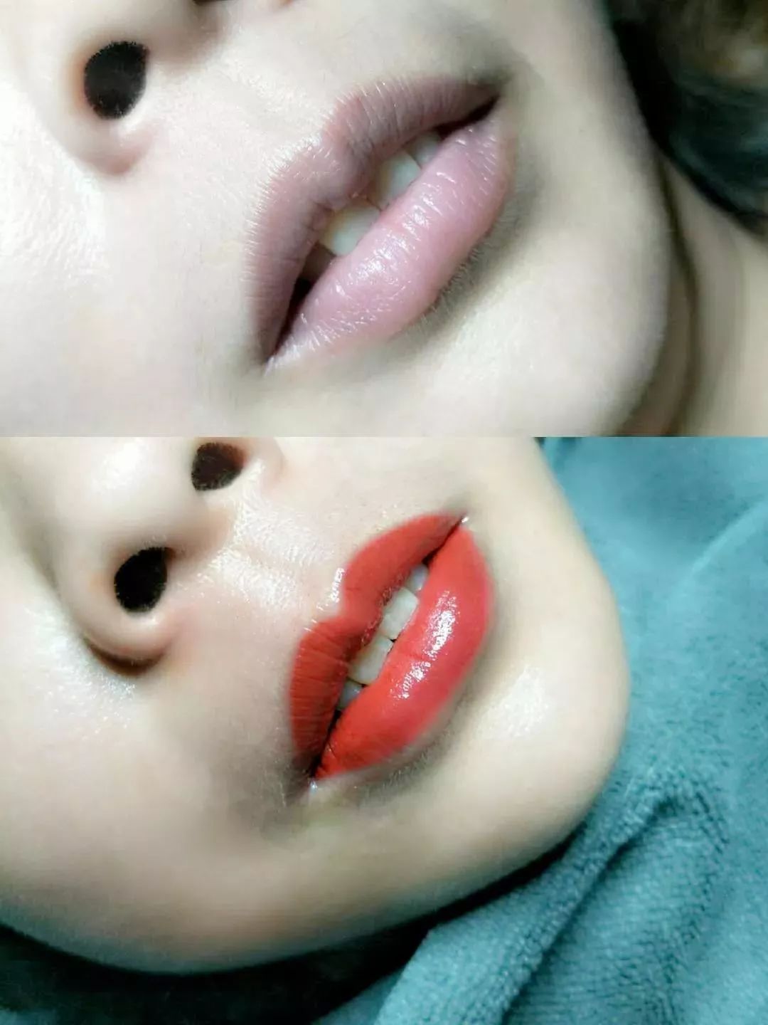 VIGROSE|纹唇项目，如何让高价更显价值？