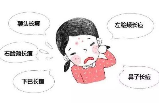 俏肌去黑头怎么样,俏肌护肤品怎么样