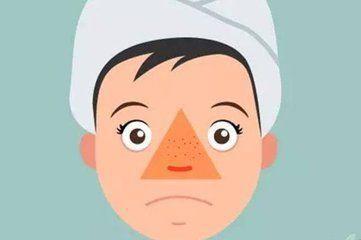 鼻子上总长脓包型痘痘怎么解决,鼻子上的脓包