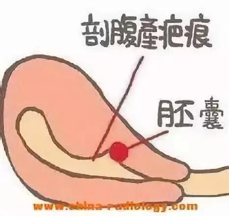 有哪些妇科疾病是正常的,你知道吗有些妇科病其实不用治