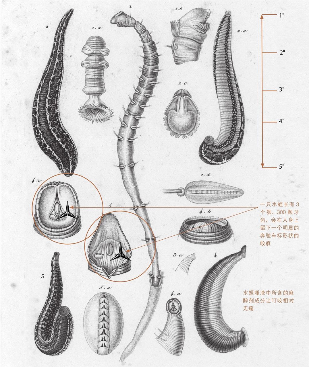 欧洲水蛭放血治疗,外国人用水蛭放在身上治病