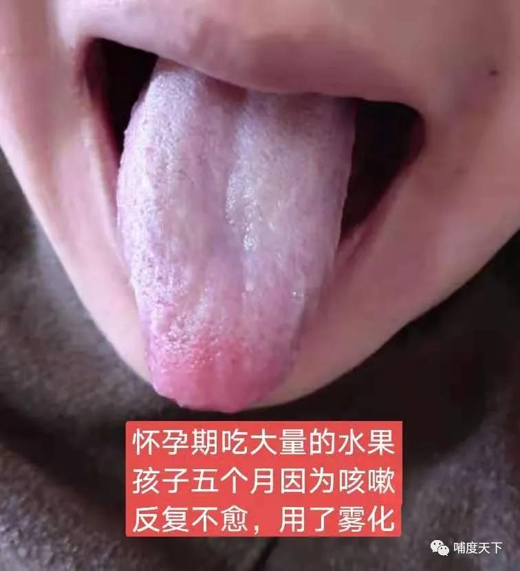 反复感冒咳嗽是什么原因引起的,哺乳期孩子咳嗽是什么原因引起的