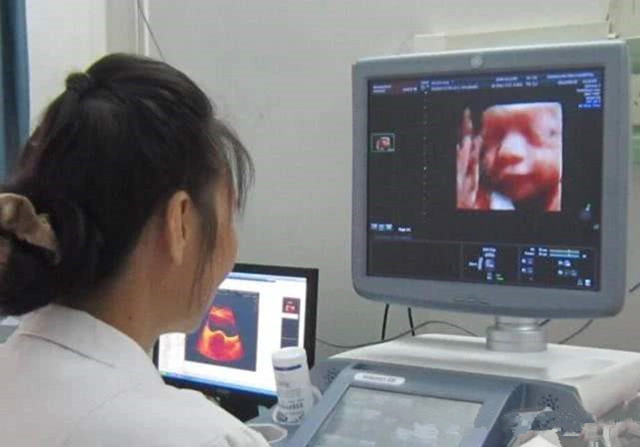 四维彩超要学会看些什么,做四维彩超就能看清宝宝健康吗