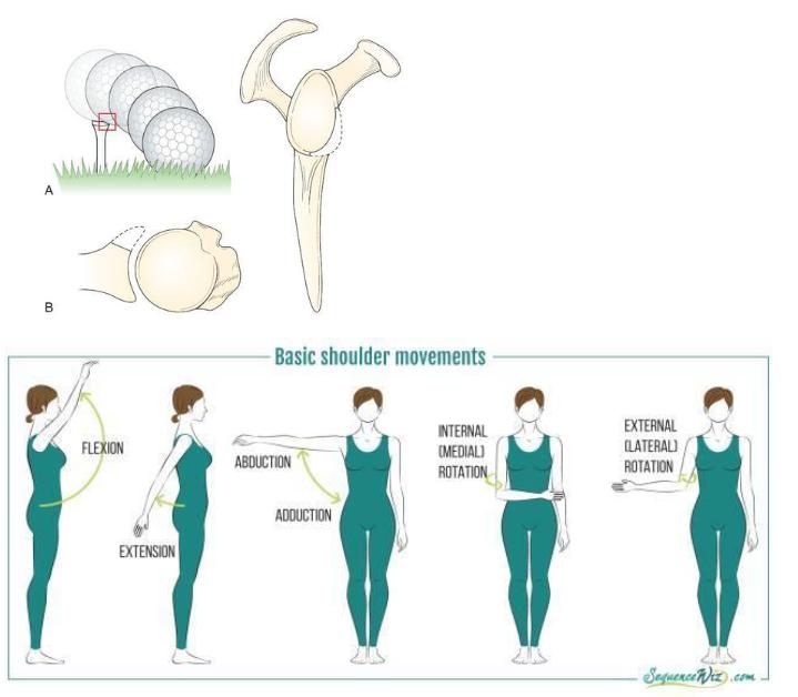 习惯性肩关节脱臼如何改善,肩关节脱位容易形成习惯性脱位吗