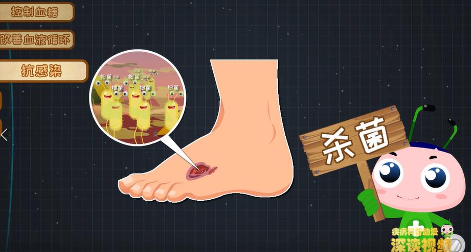 控糖？抗感染？治疗糖足哪招强？动漫解读最新黑科技，爆