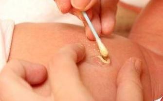 新生儿肚脐眼怎么消毒擦拭,婴儿肚脐眼需要消毒吗