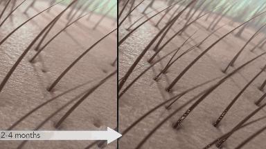 头发蓬松茶树油洗发水,油头救星澳洲茶树洗发水