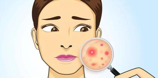 油光型毛孔粗大护肤步骤,收缩毛孔粗大的方法干皮敏感肌