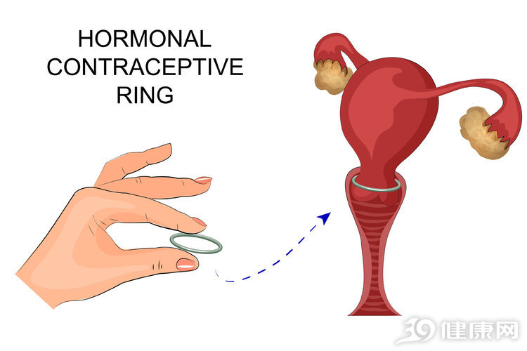 医生不建议补雌二醇,医生说雌激素过高什么意思