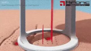 收缩毛孔的7个专家建议,收缩毛孔的最好方法一个月