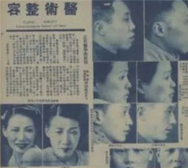 中国哪家整容医院割双眼皮好,上海哪家整容医院做双眼皮最好