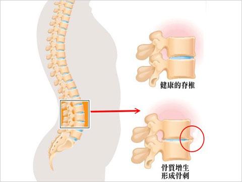 囊肿息肉结节体质如何中医调理,囊肿增生息肉