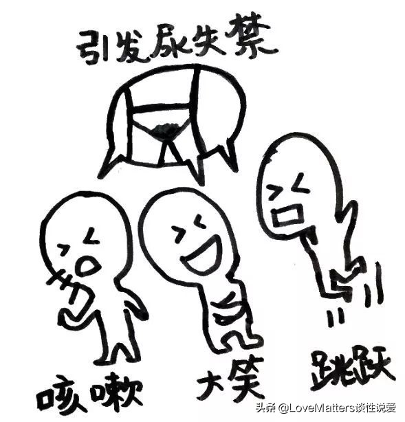 ella产后尿失禁案例,ella漏尿手术