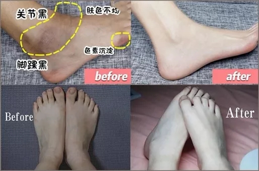 去角质的搓澡巾,加厚去角质搓澡巾