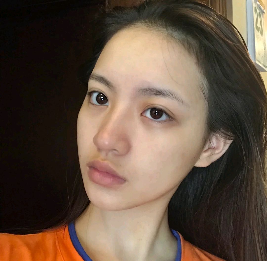 战痘舒缓精华,乐敦祛痘祛印霜测评