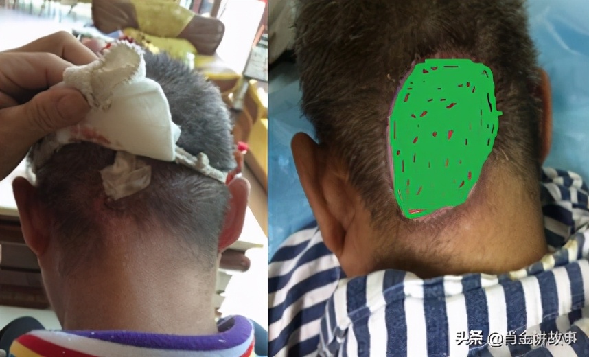 中国好人丁伟强,丁伟强医生