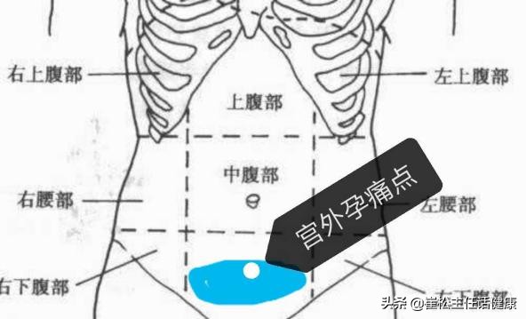 疫情有腹痛症状吗,有没有疫情期间肚子疼