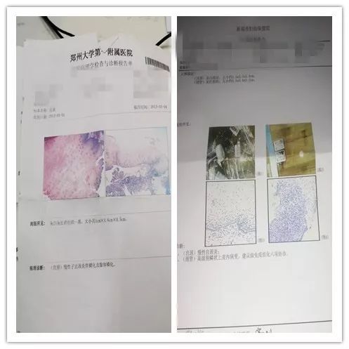 预防宫颈癌hpv疫苗价格,hpv可以预防宫颈癌吗