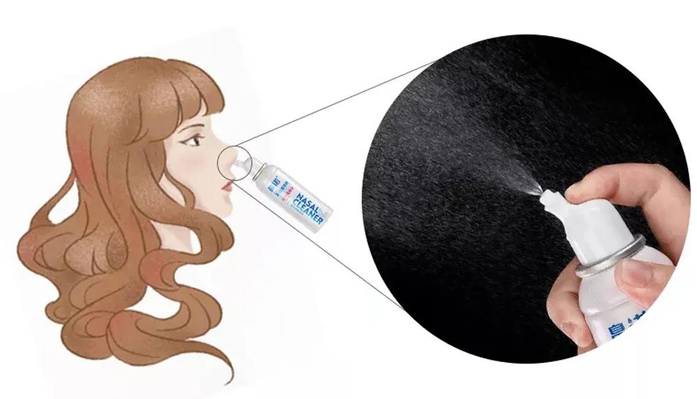 怎么知道鼻炎是哪种鼻炎,鼻炎里面最严重的是哪种鼻炎