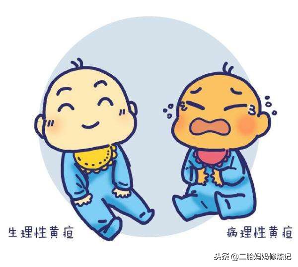 宝宝黄疸多久才能完全退,宝宝黄疸别担心日间光疗