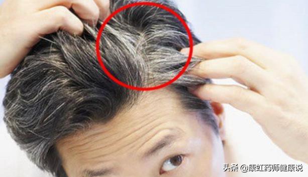 长白头发代表老了吗,年轻人长白头发的原因及调理