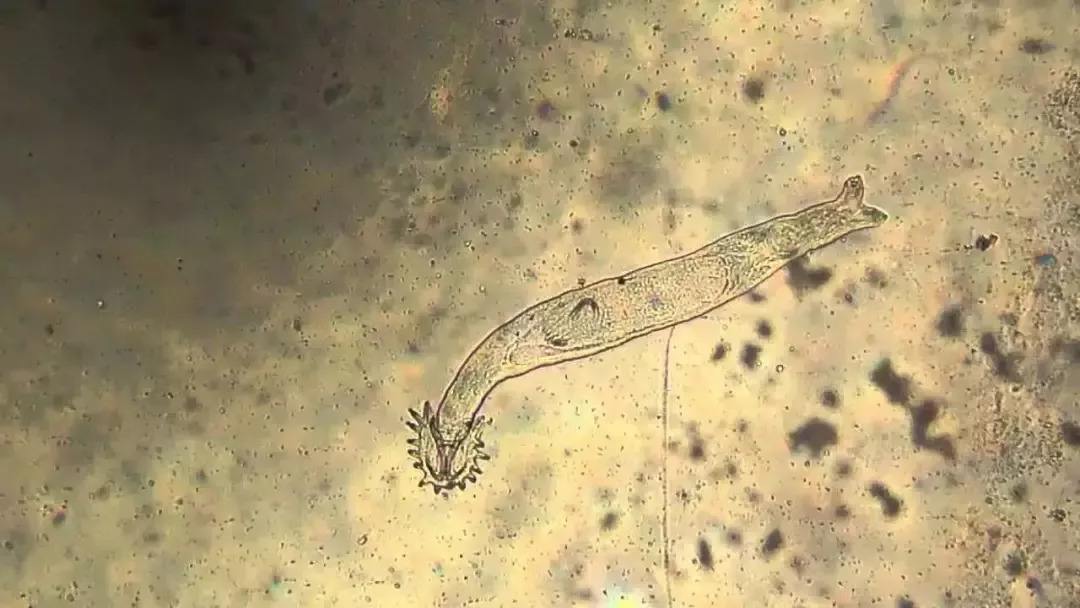 虾有寄生虫吗可以吃生的虾吗,大虾里有寄生虫么