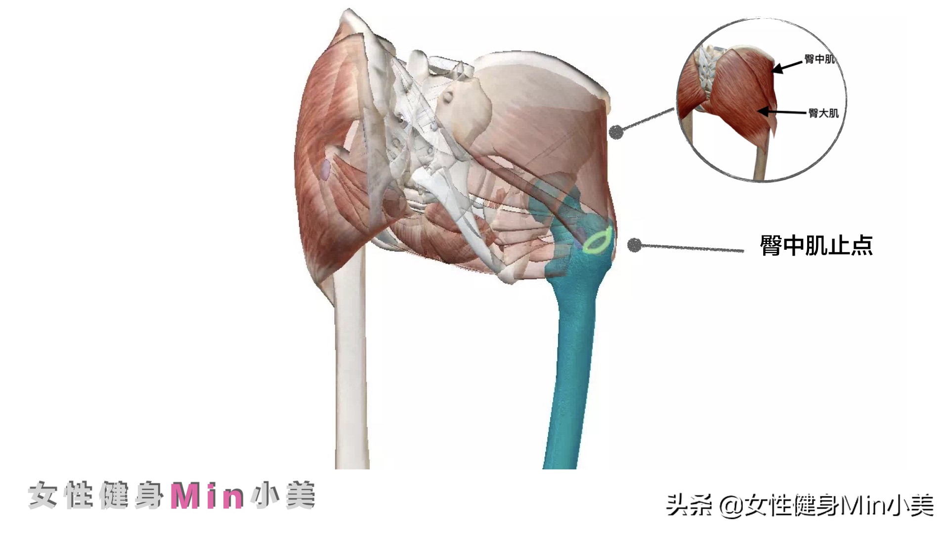 臀中肌变大是怎么回事,臀凹陷不能全是练臀中肌解决