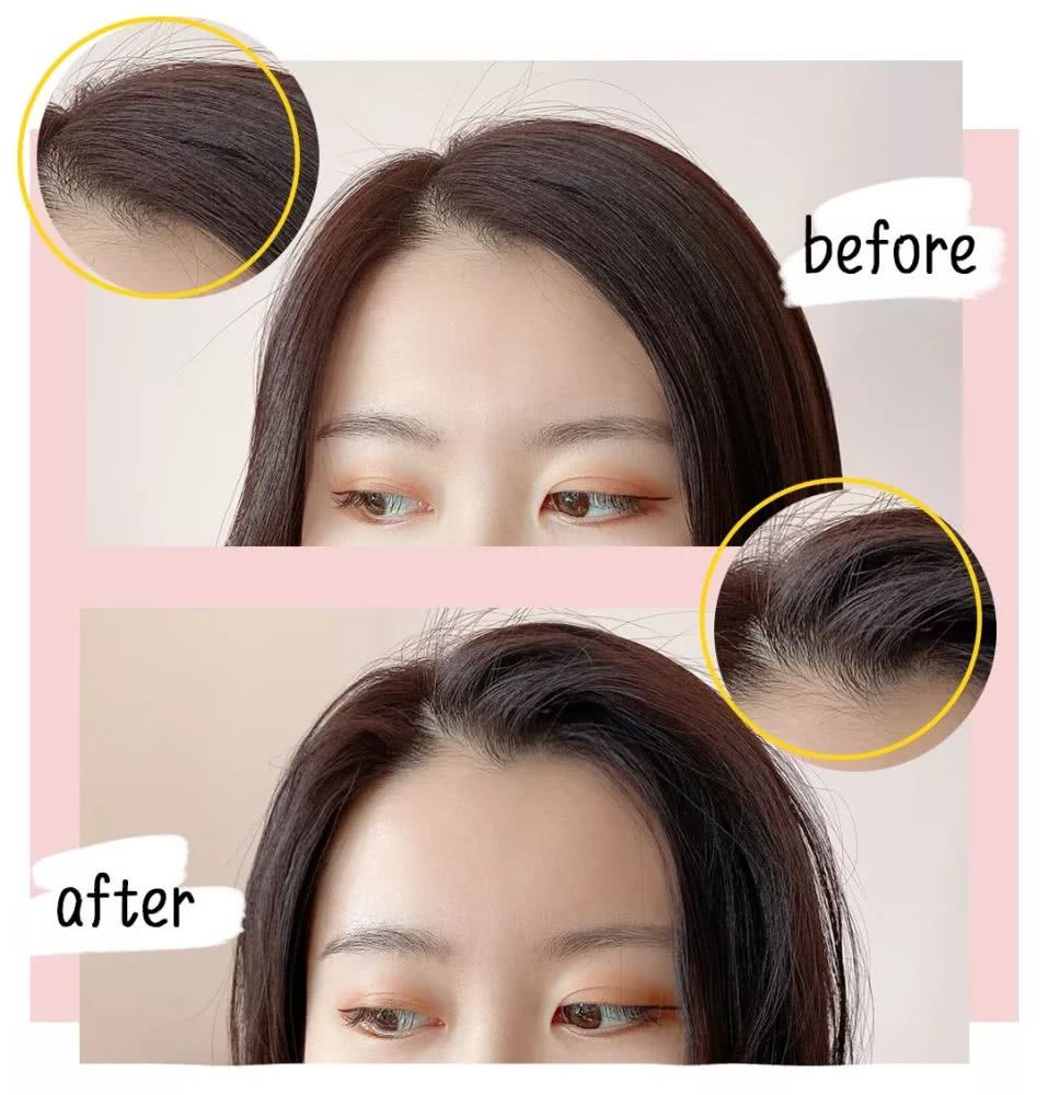 刘海油塌贴头皮怎么办,刘海油头发干枯