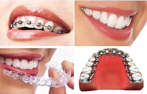 大连口腔医院矫正牙齿靠谱吗,大连齿医生口腔矫正