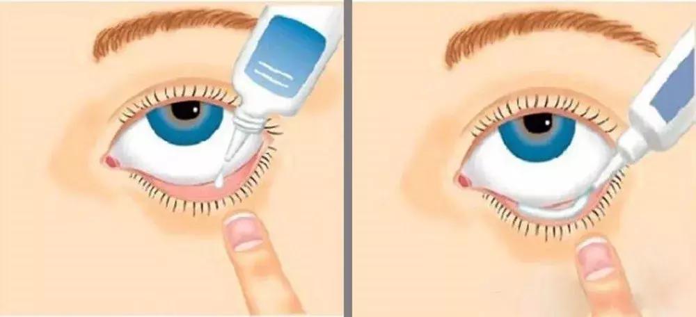 哪些禁售的日本网红眼药水,日本网红眼药水还在卖吗