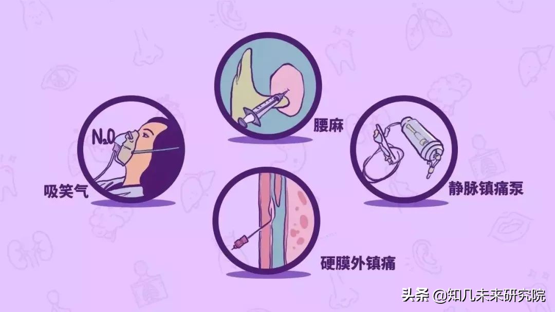 全国第一批无痛分娩试点医院,国内无痛分娩医院名单